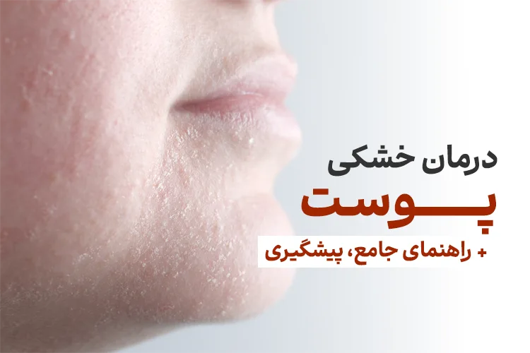 خشکی پوست یکی از مشکلات شایع پوستی است که بسیاری از افراد در سراسر جهان با آن مواجه هستند.