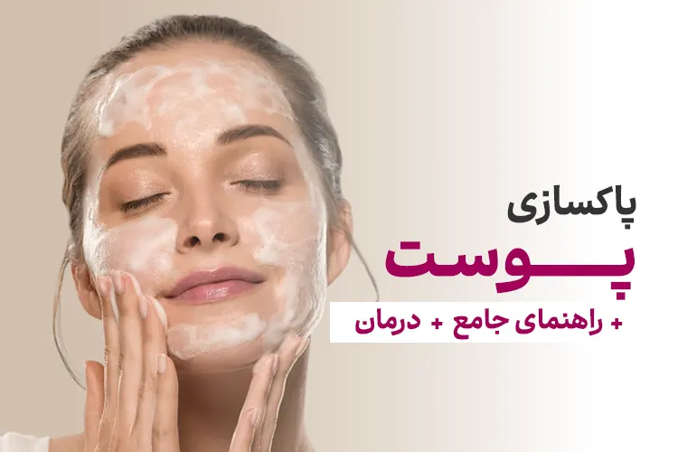 پاکسازی پوست: راهنمای جامع + درمان خانگی + 3 روش پاکسازی پوست Cleansing the skin