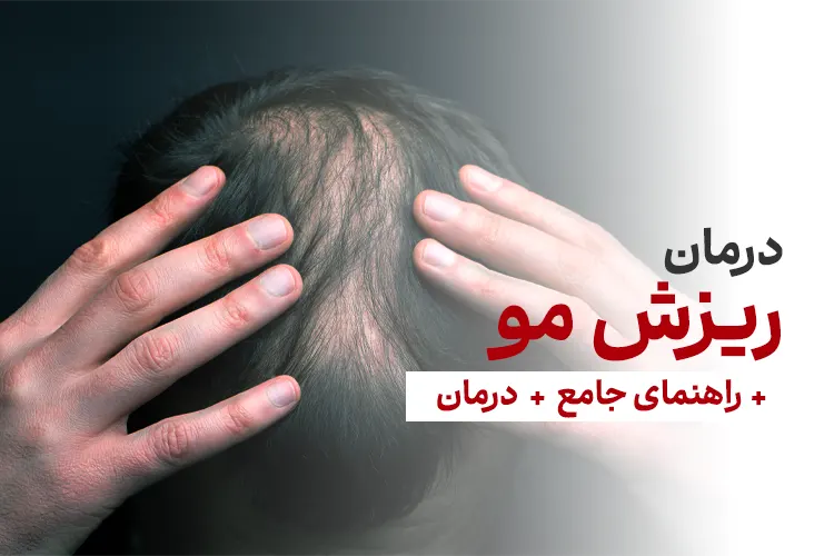 راهنمای جامع جلوگیری از ریزش مو: درمان‌های خانگی، علل و نکات پیشگیری