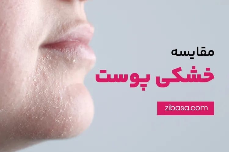 صورت، چانه، لب یک زن که پوست آن خشک است- درمان سریع خشکی پوست صورت