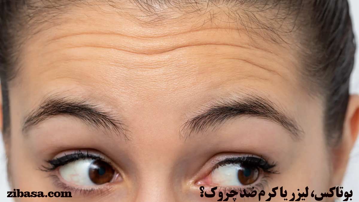 بوتاکس، لیزر یا کرم ضد چروک؟
