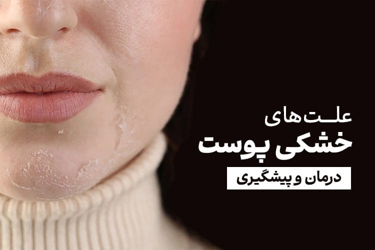 علت خشکی پوست